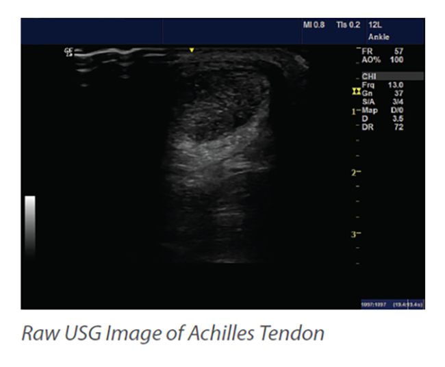 AI-Powered-Diagnostic-Solution-for-Musculoskeletal-Injury-Assessment-3-1