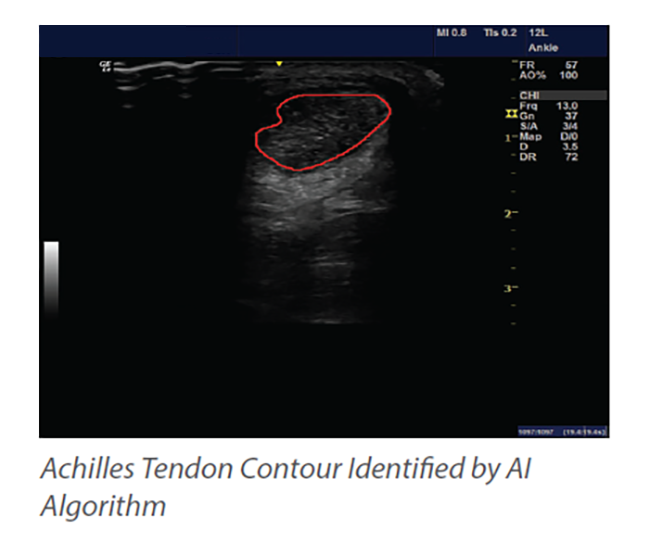 AI-Powered-Diagnostic-Solution-for-Musculoskeletal-Injury-Assessment-4-1