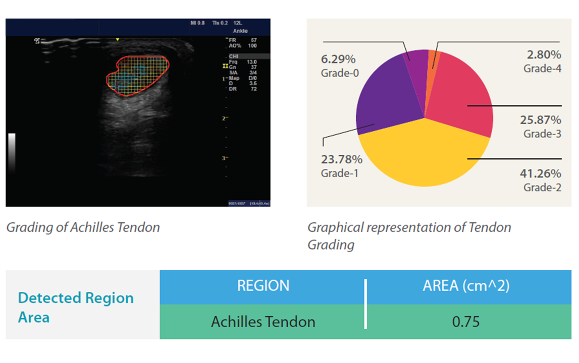 AI-Powered-Diagnostic-Solution-for-Musculoskeletal-Injury-Assessment-5-1