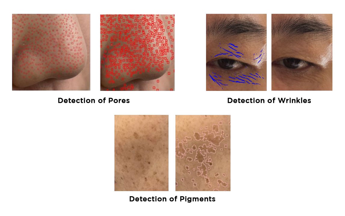 Skin-pores,-moisture-content-and-skin-pigmentation-detection-1